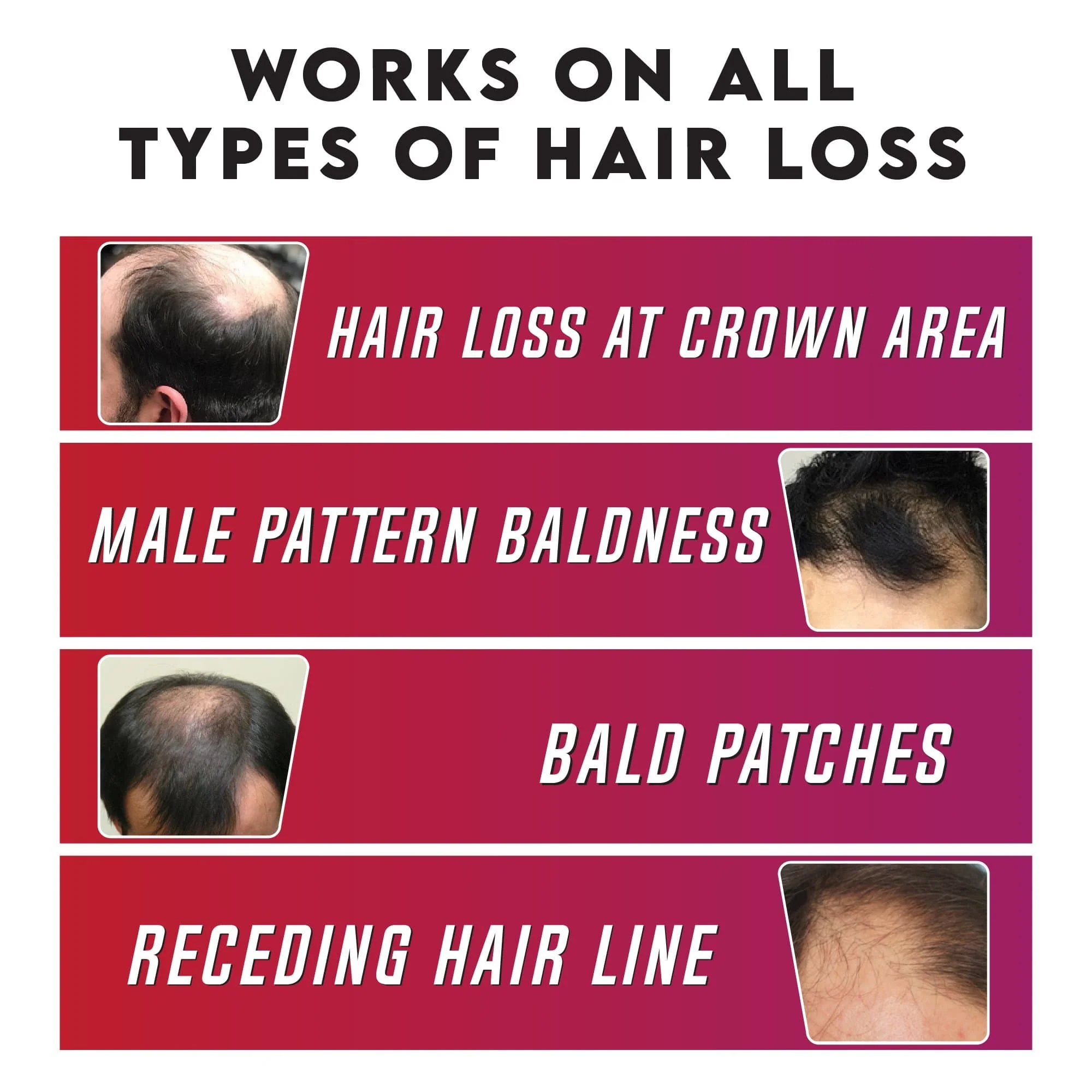 YogaManLab® KEROPROTEIN® Hair Growth Topical Oil 30mL (Men) | Made From Natural Ayurvedic Plant Oils | With Proven To Work Research Based Ingredients - Image 4