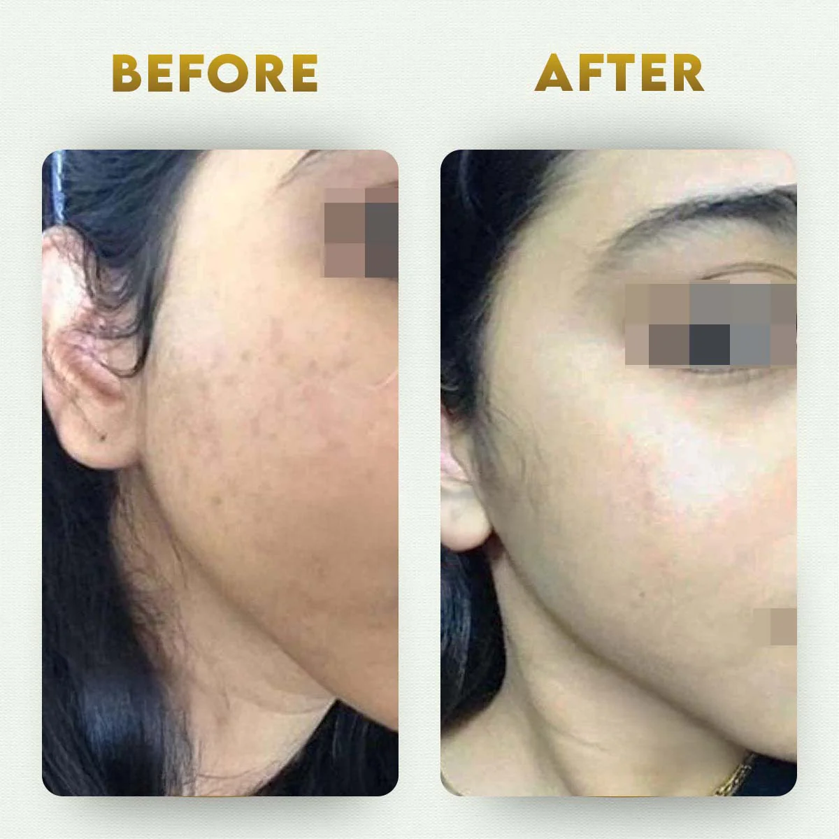 YogaManLab® Multani Mitti Glow Face Pack – For Deep Pore Cleansing, Acne Defense & Tan Removal (With Chandan, Turmeric & Orange Peel) - Image 13
