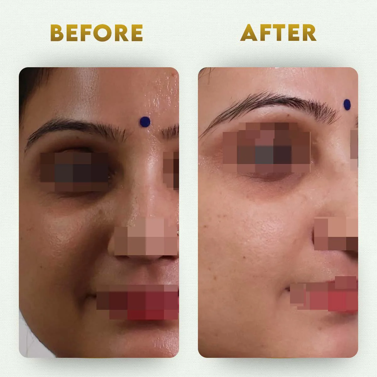 YogaManLab® Multani Mitti Glow Face Pack – For Deep Pore Cleansing, Acne Defense & Tan Removal (With Chandan, Turmeric & Orange Peel) - Image 3
