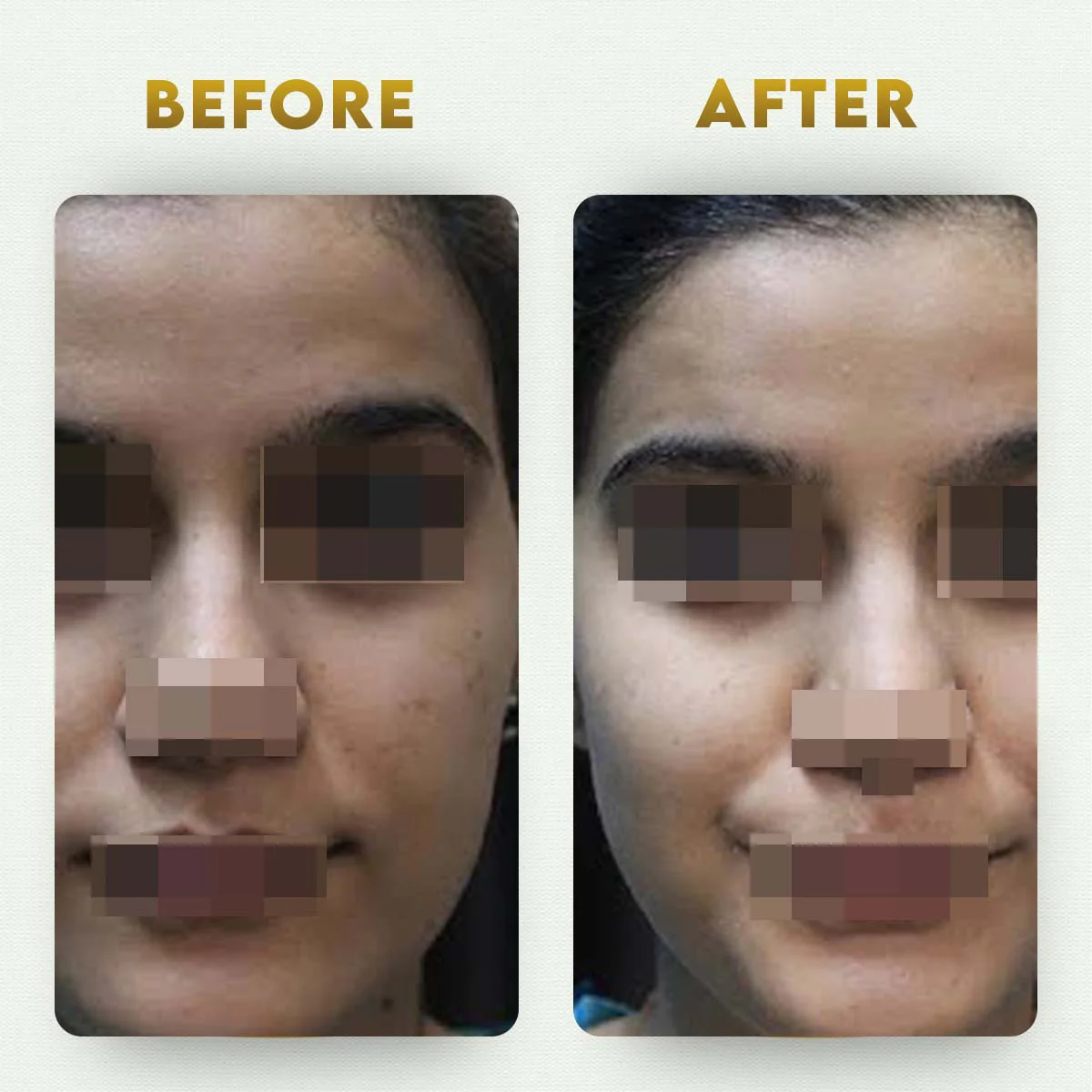 YogaManLab® Multani Mitti Glow Face Pack – For Deep Pore Cleansing, Acne Defense & Tan Removal (With Chandan, Turmeric & Orange Peel) - Image 5