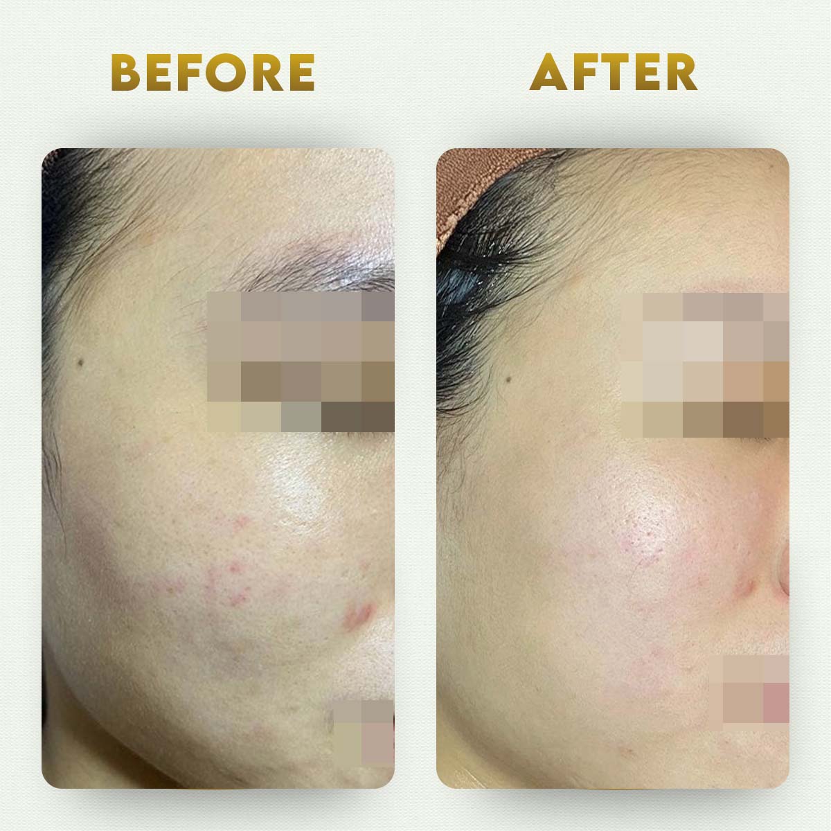 YogaManLab® Multani Mitti Glow Face Pack – For Deep Pore Cleansing, Acne Defense & Tan Removal (With Chandan, Turmeric & Orange Peel) - Image 7