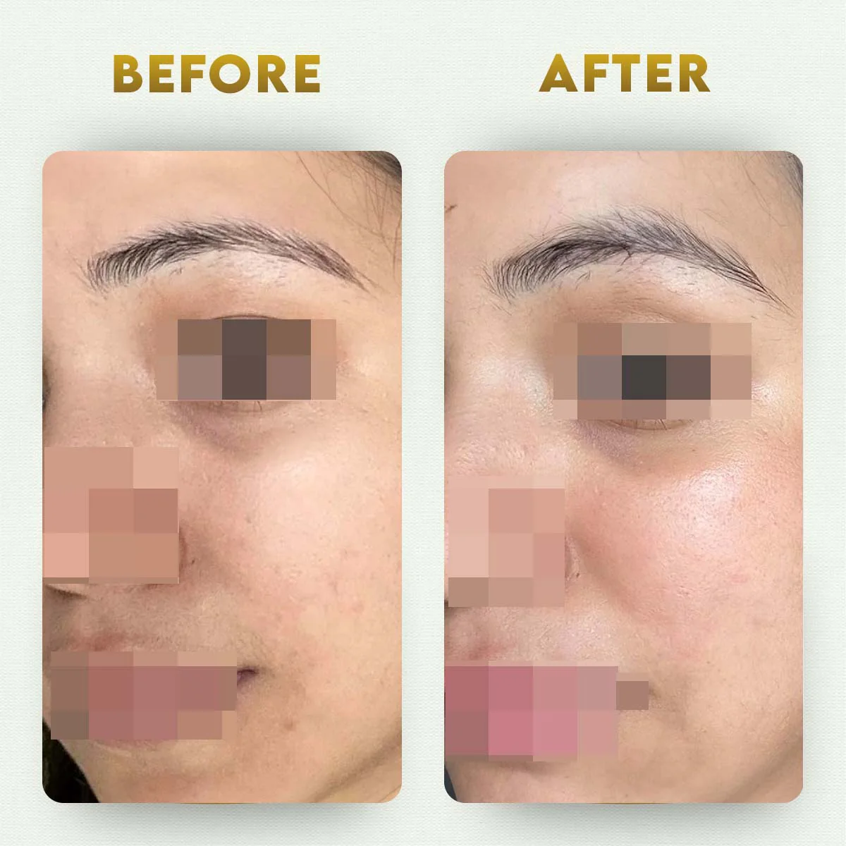YogaManLab® Multani Mitti Glow Face Pack – For Deep Pore Cleansing, Acne Defense & Tan Removal (With Chandan, Turmeric & Orange Peel) - Image 9