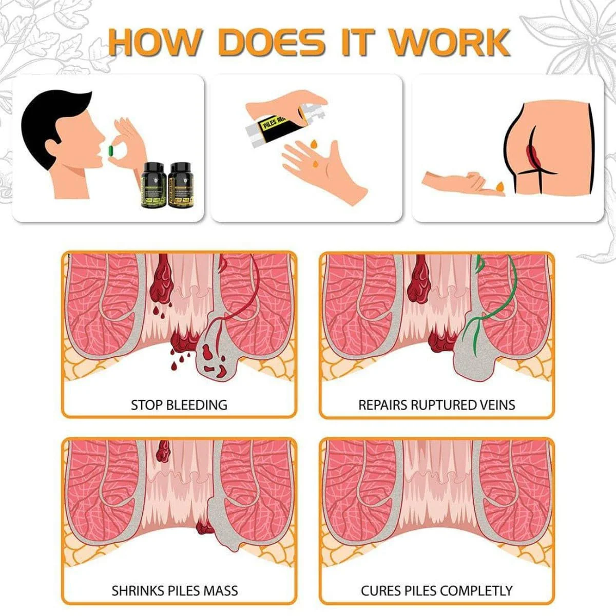 YogaManLab® Piles Matrix - वेन रिस्टोर + रेक्टम रिस्टोर+ डाइट बुकलेट - Image 2