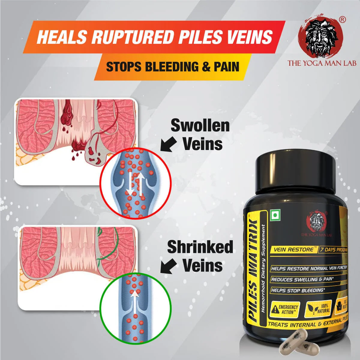 YogaManLab® Piles Matrix - वेन रिस्टोर + रेक्टम रिस्टोर+ डाइट बुकलेट - Image 3
