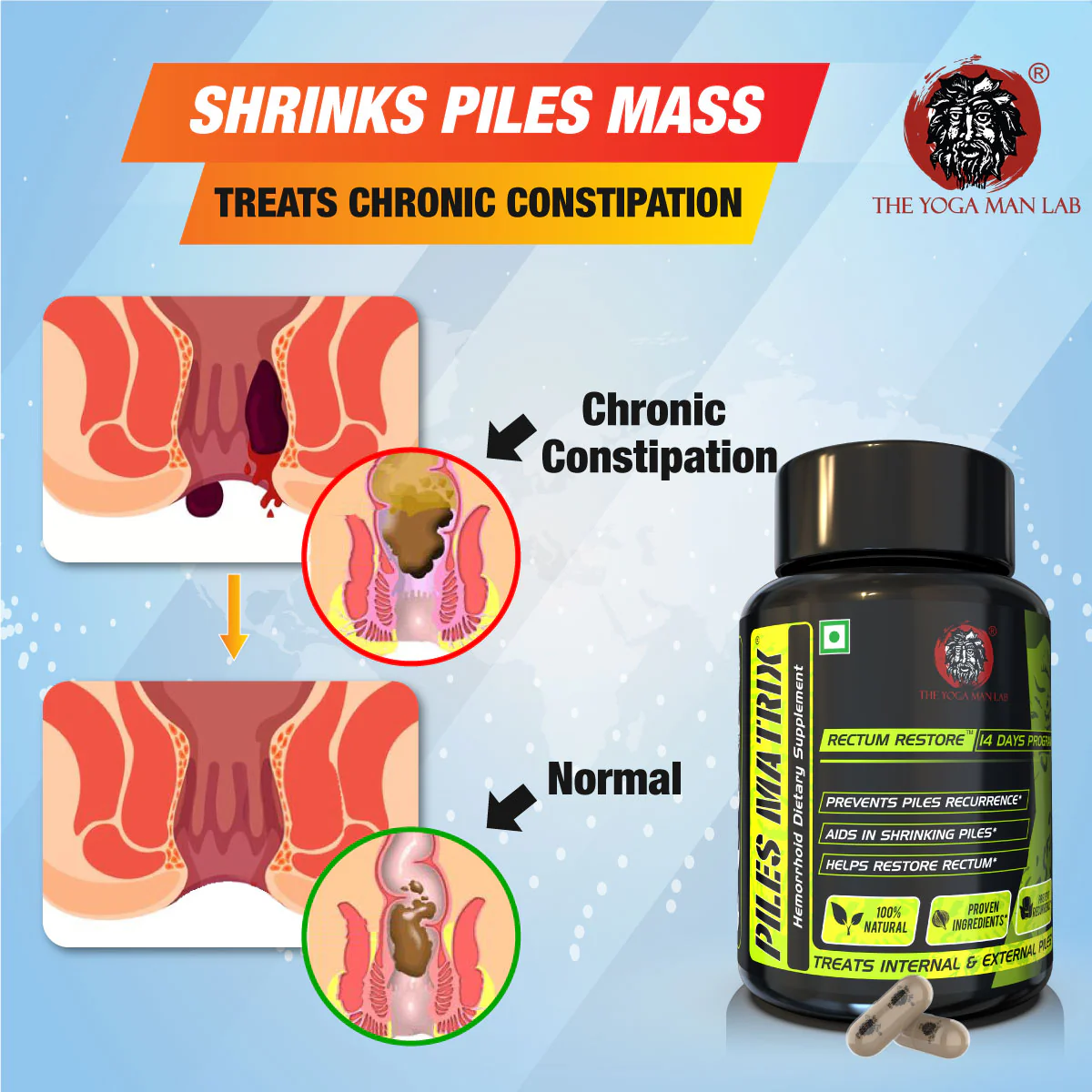 YogaManLab® PILES MATRIX - RECTUM RESTORE Ayurvedic Supplement | Shrink Piles Lumps & Mass and Treats Constipation | 100% Natural - Image 3