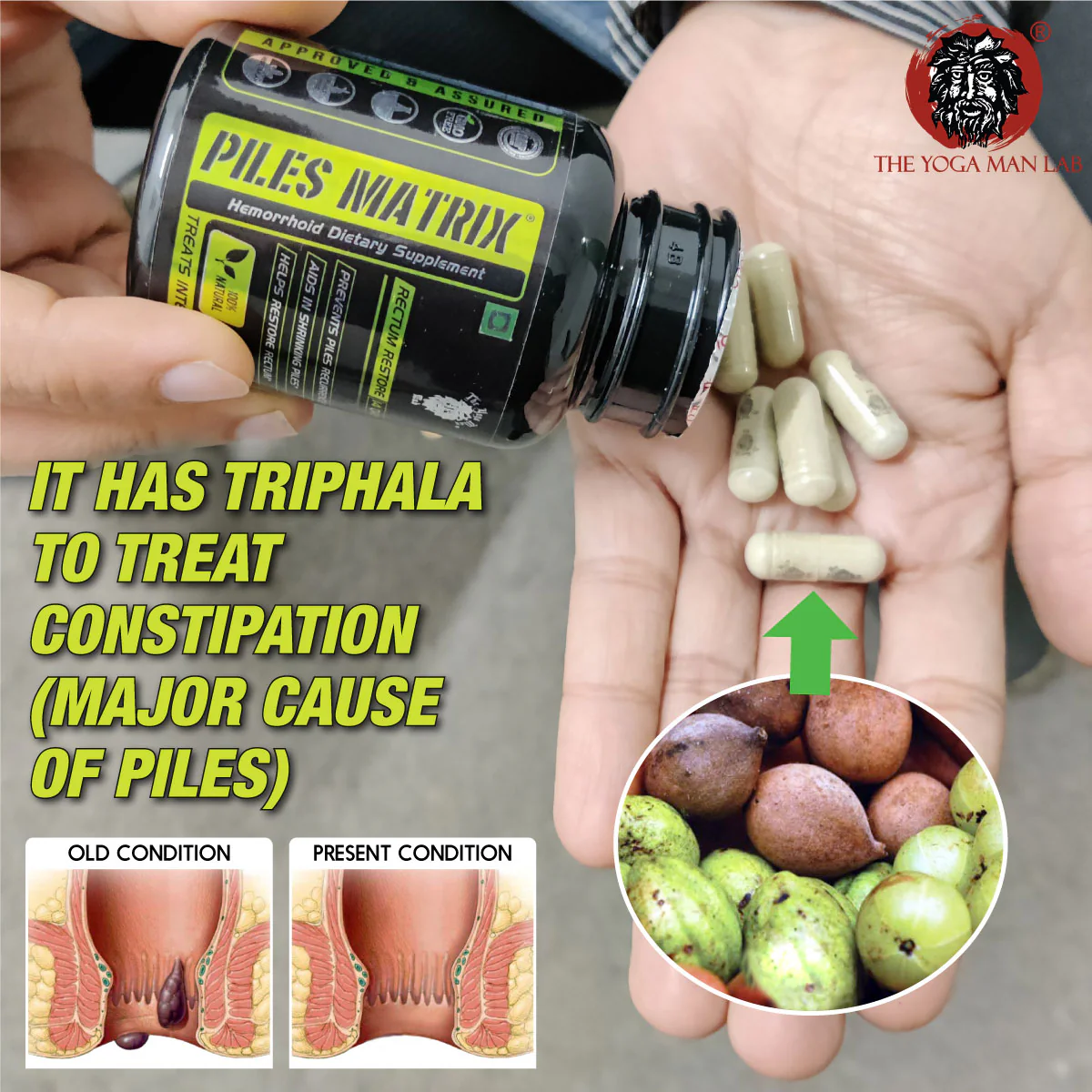 YogaManLab® PILES MATRIX - Vein Restore + Rectum Restore Ayurvedic Supplements + Herbal Remedies Diet Booklet | Relives Pain & Shrinks Mass | 100% Natural - Image 8