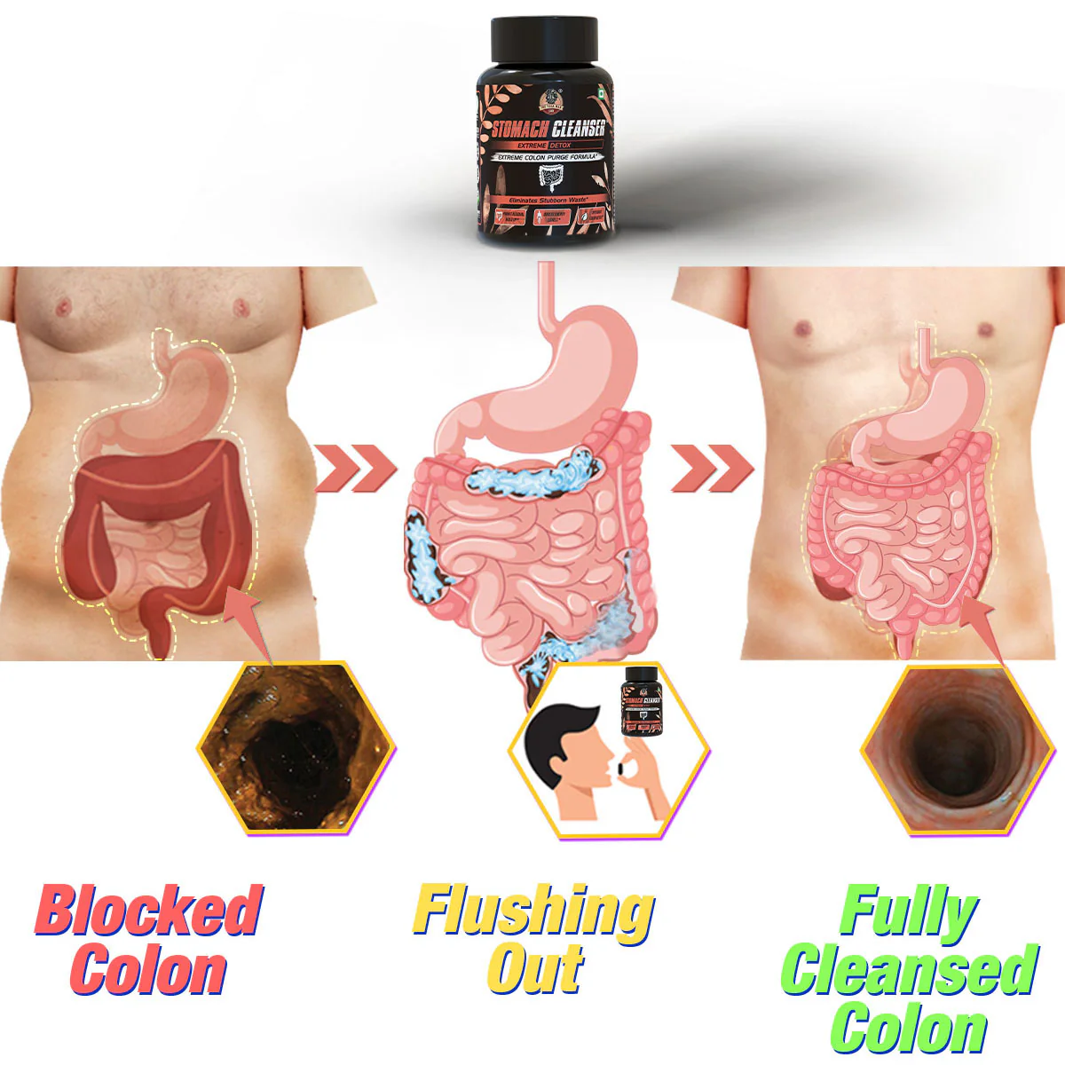 YogaManLab® STOMACH CLEANSER- Extreme Detox Ayurvedic Supplement | For People With Delayed Motion & Hard Stool | 100% Natural - Image 7