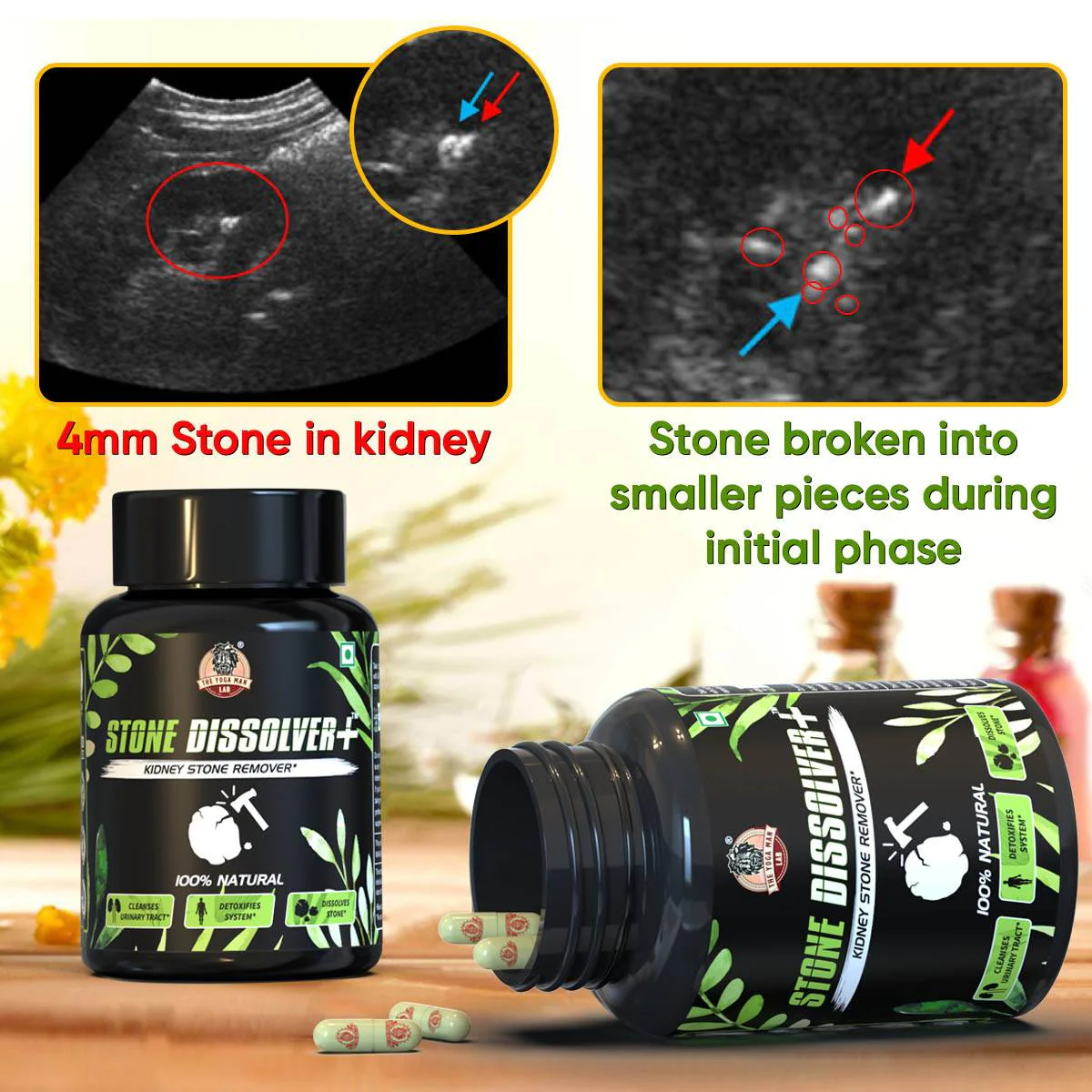 YogaManLab® STONE DISSOLVER+ - Stone Remover Ayurvedic Supplement | 100% Natural & Plant Based - Image 5