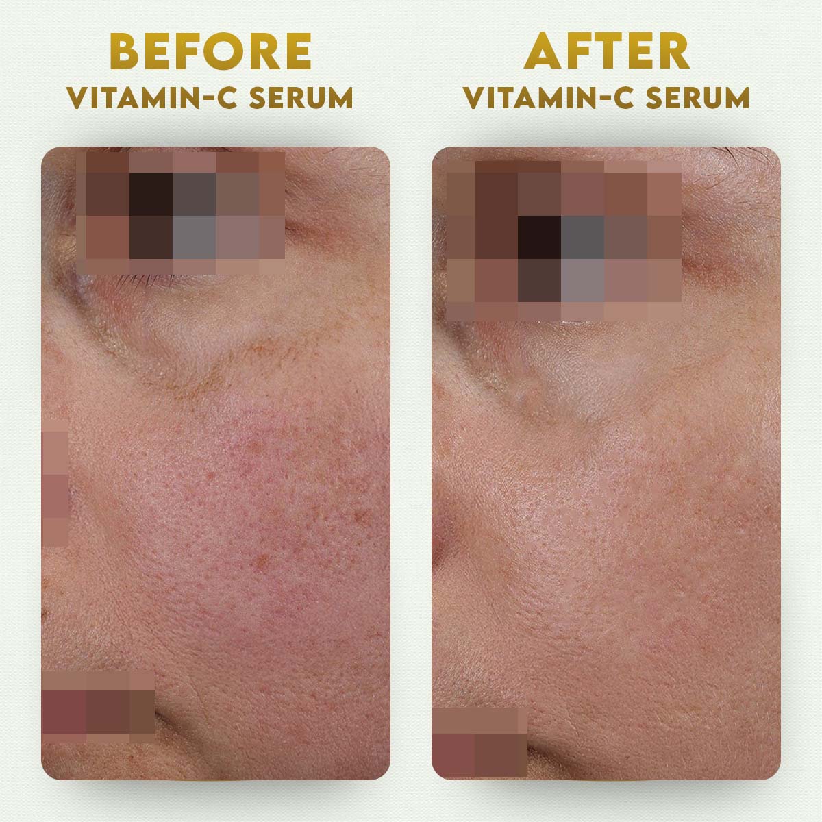YogaManLab® 10% Pure Vitamin-C & 0.5% Ferulic Acid Face Serum | Brightens Dull Skin, Evens Tone - Image 10