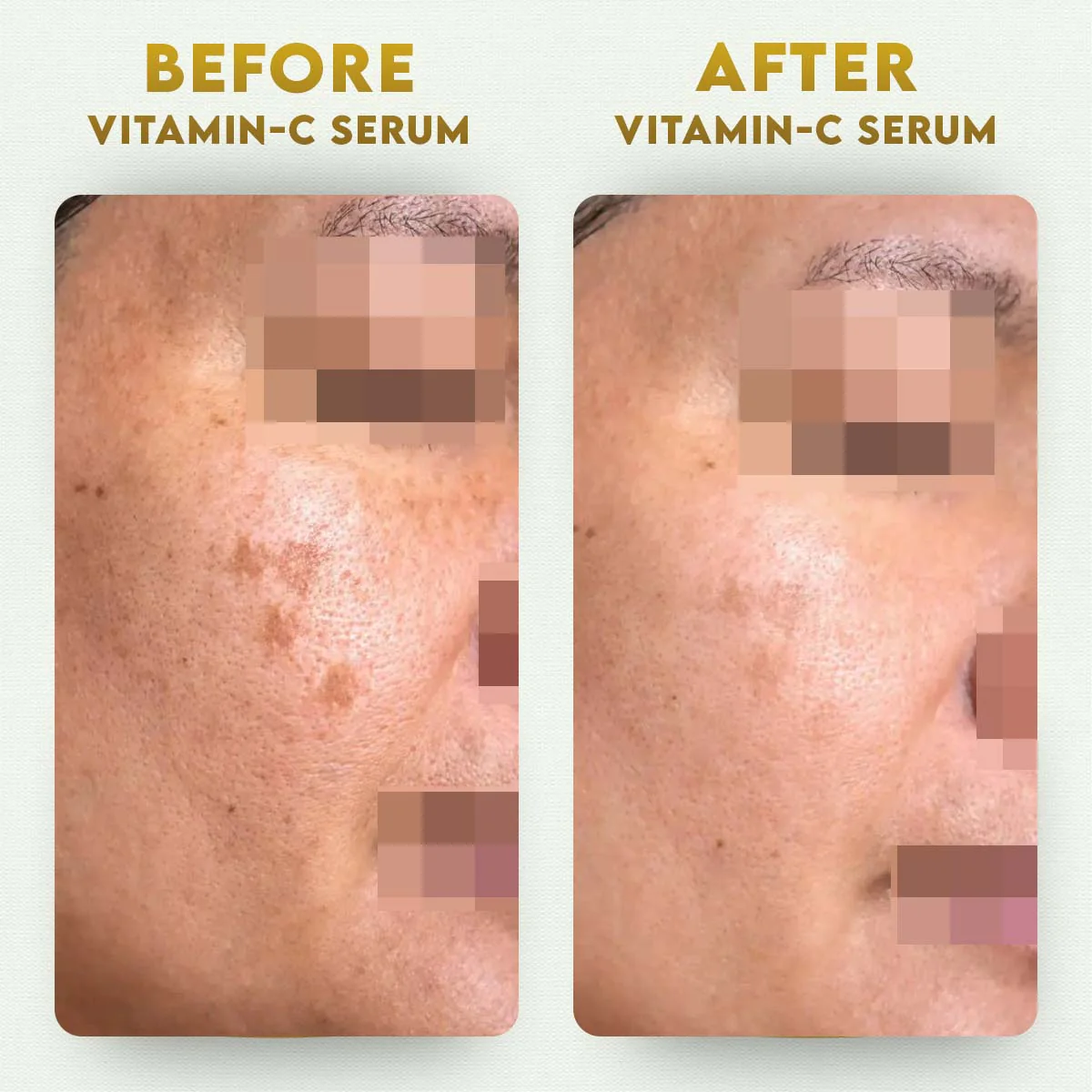 YogaManLab® 10% Pure Vitamin-C & 0.5% Ferulic Acid Face Serum | Brightens Dull Skin, Evens Tone - Image 9